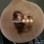 Coin image for CyzNCRtaFB4zoSa2FsqUPGfHBAtJX2Qiih8hMyTP95VX